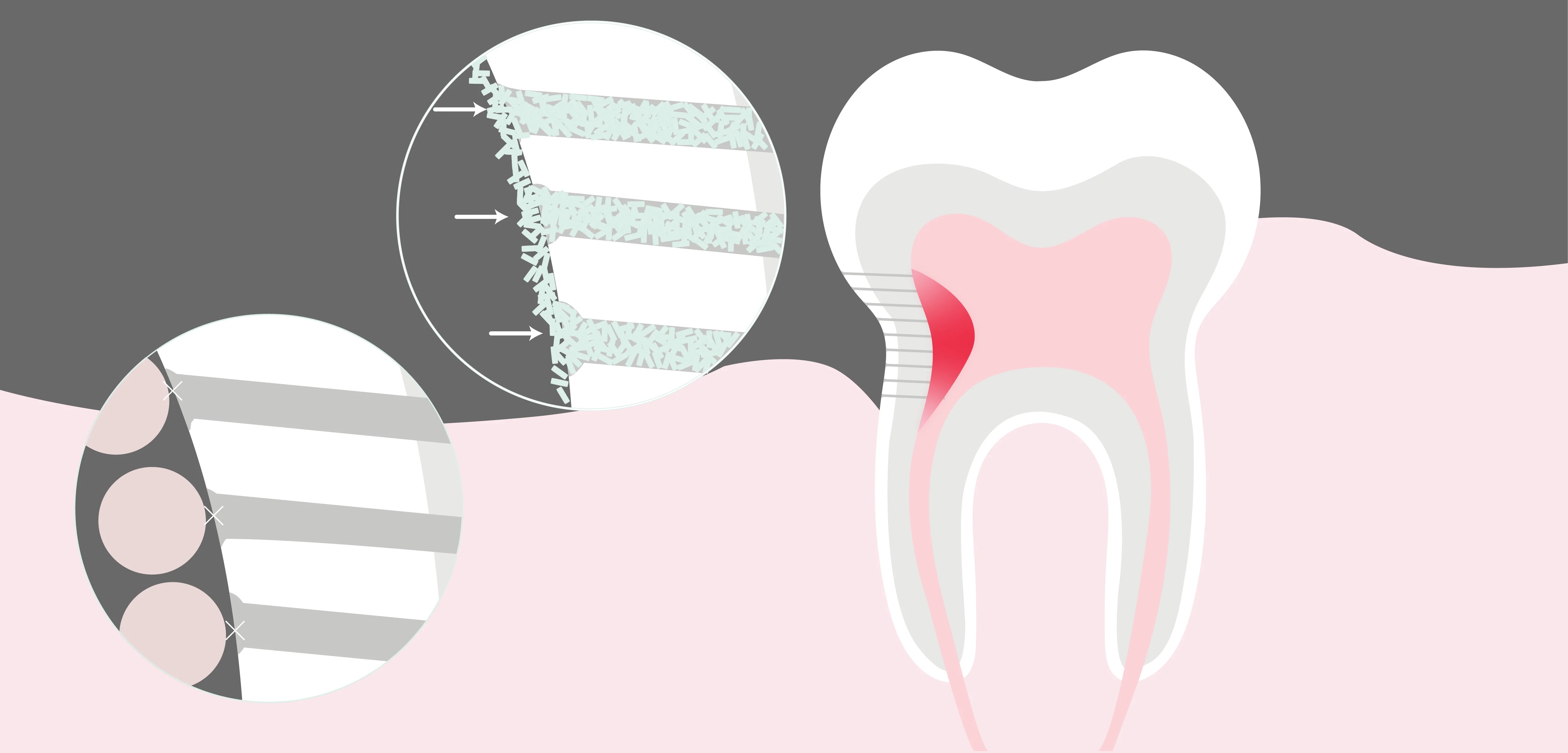 nano-hydroxyapatite-enamel